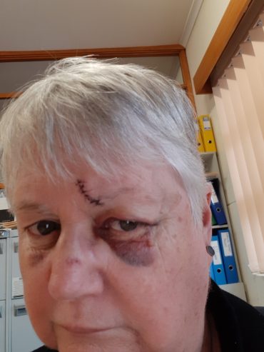 suspected domestic violence